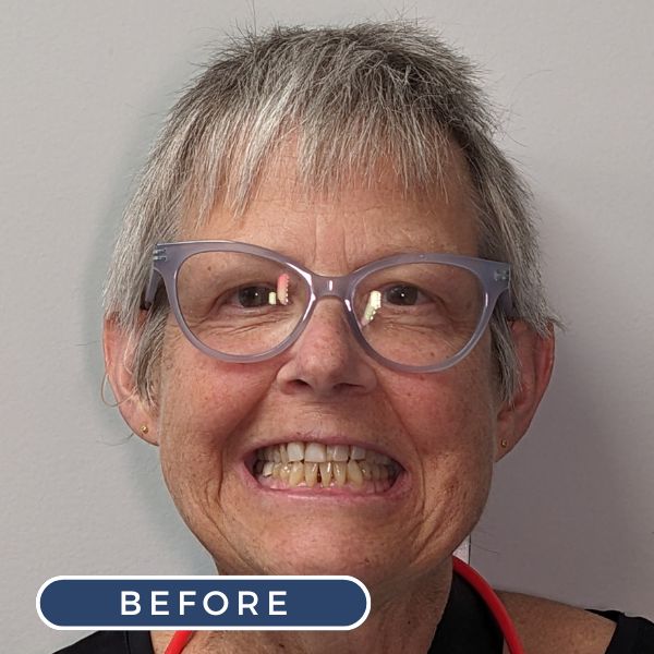 smile makeover easton pa