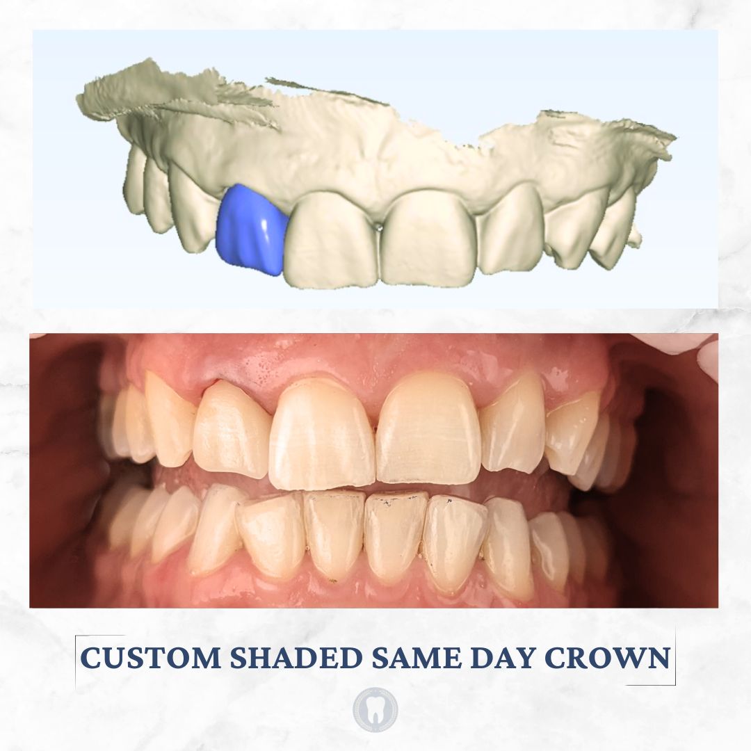 same day crown easton pa