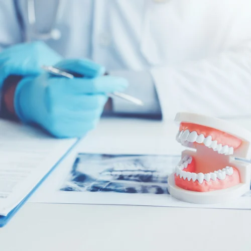 Oral Surgery Recovery Tips