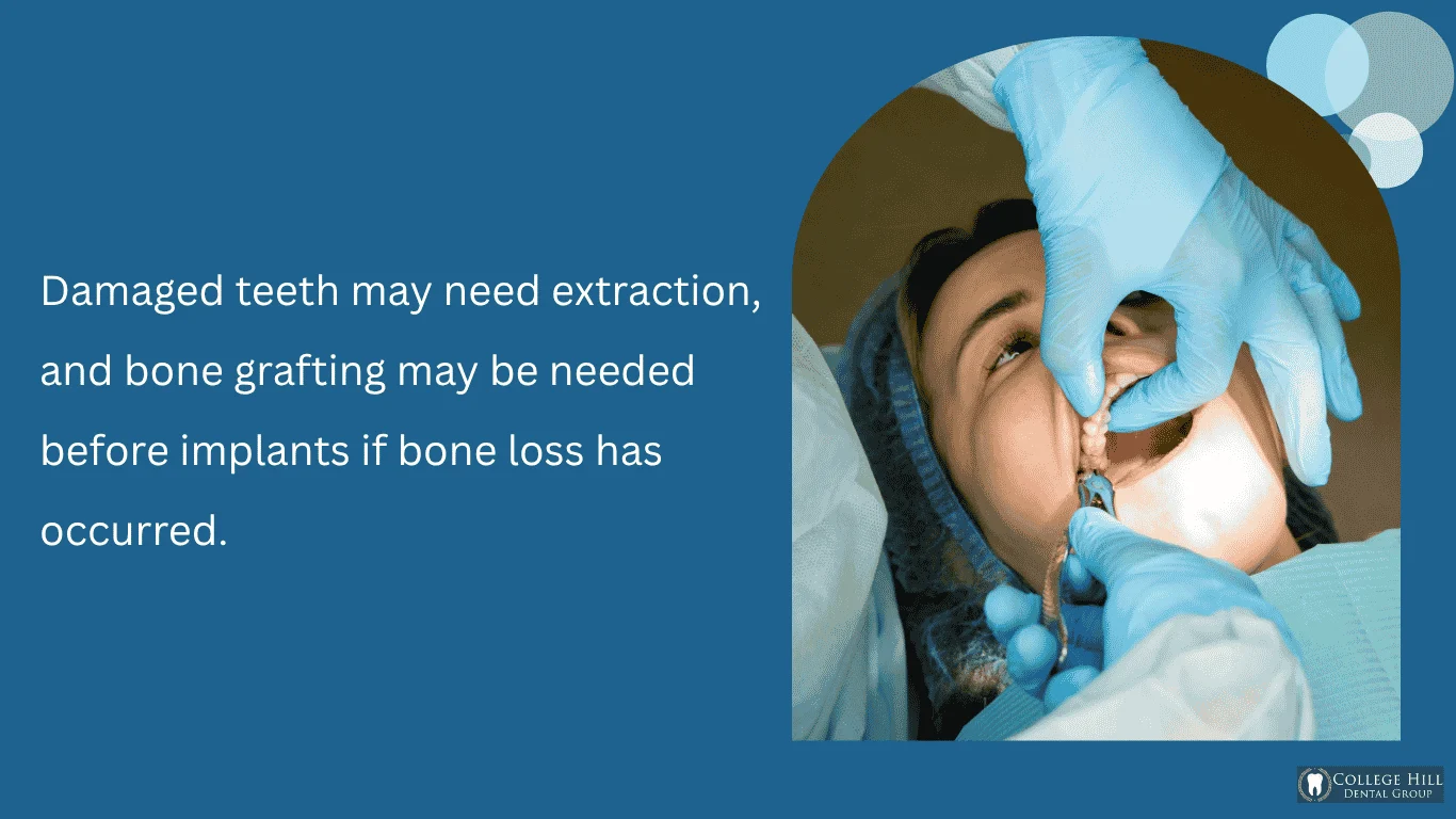 Extractions and Bone Grafting When Needed