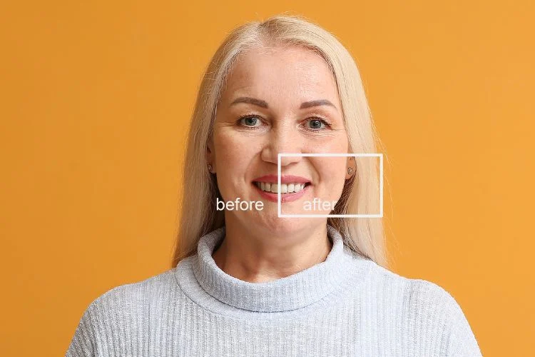 Smile Makeover Options That Look Natural