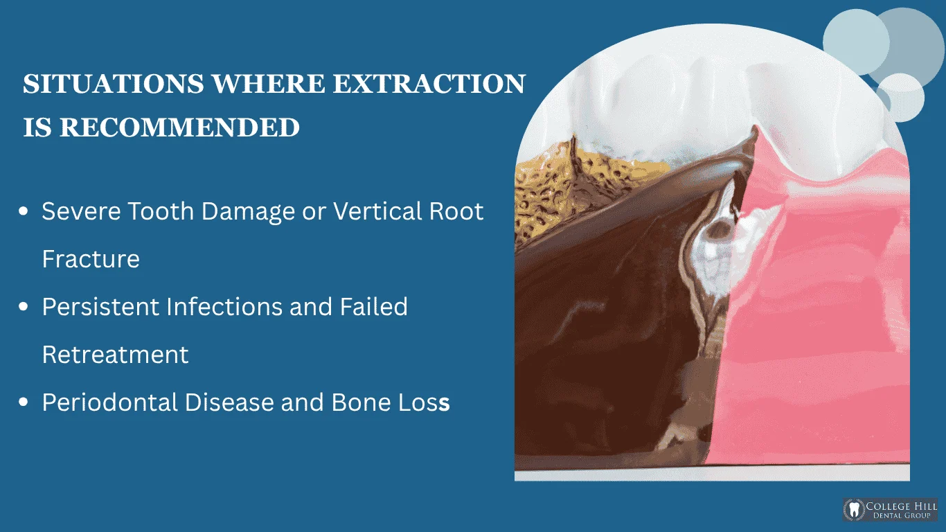 When Is Extraction the Better Option