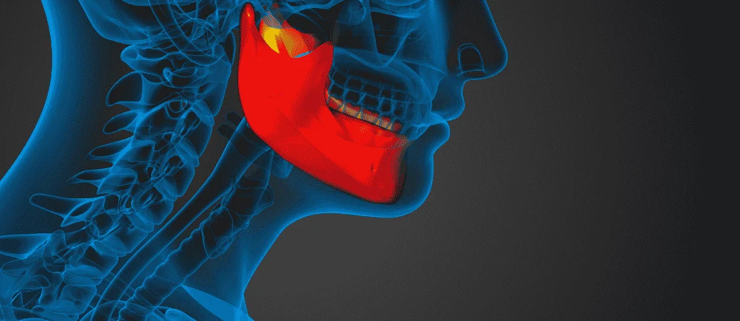 Why Does My Jaw Click When I Chew? When It’s TMJ and When It’s Something Else