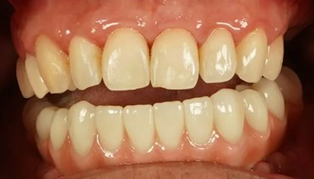 smile gallery 05 after