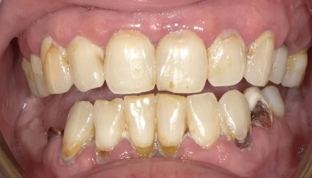 smile gallery 05 before